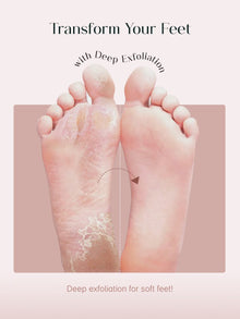 Exfoliating Foot Peel & Whitening Mask (One pair)