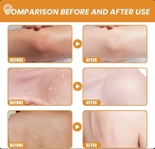 Orange Zyme Deep Clean Gel – Soft & Bright Skin Solution